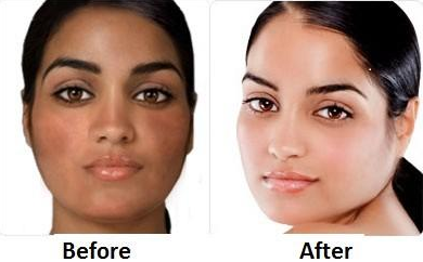 How to Lighten Skin, Fast, Overnight, Naturally, Permanently, Home 