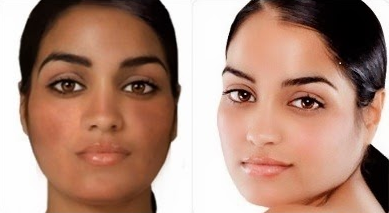 Before and after glutathione Lightskincure